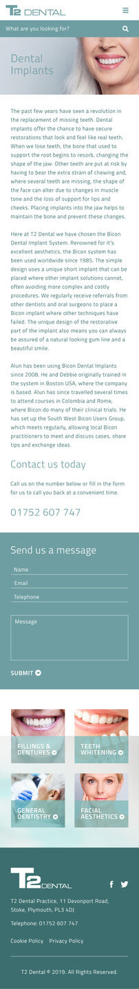 v1-T2-Mob-Implants-page